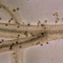 plant roots interacting with arbuscular mycorrhizal fungi credit luginbuehl lab