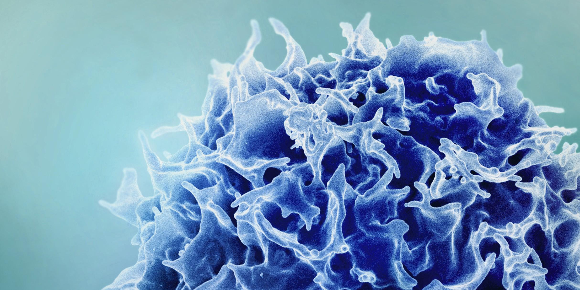 Colorized scanning electron micrograph of a T lymphocyte (also known as a T cell) (blue). Credit: NIAID